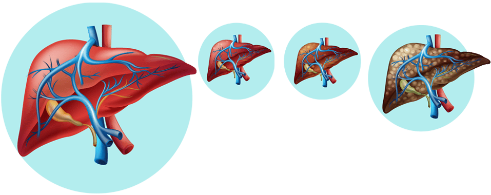 What is hepatitis?
